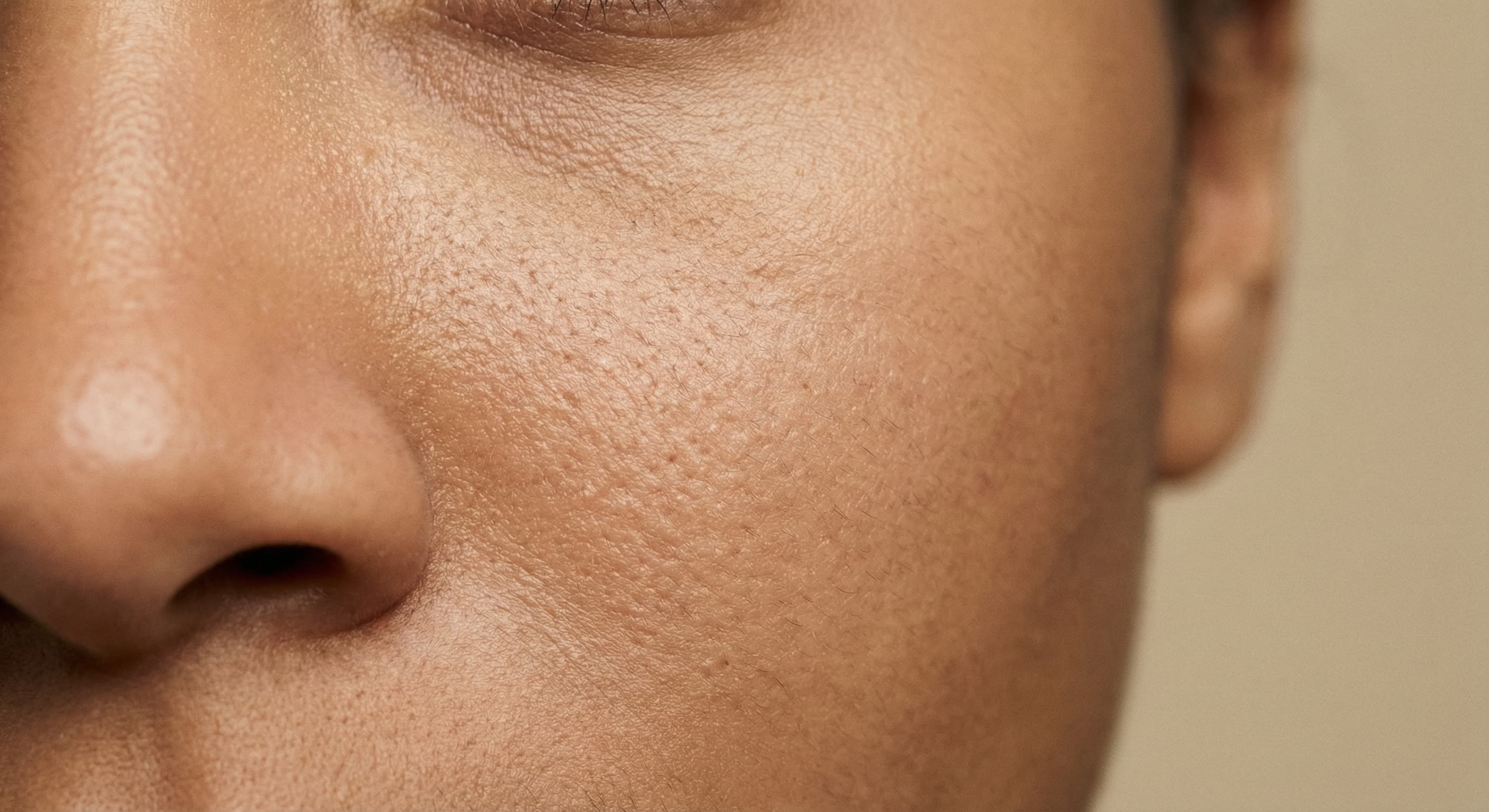 Close-up of cleared skin that keeps pores and natural texture